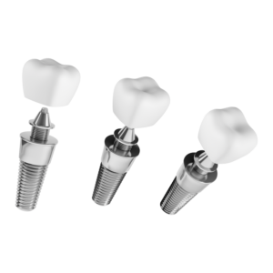 Dental Inplants